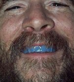 blueteeth2.jpg